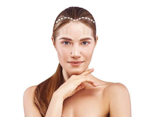 Forehead and Brow Lifting