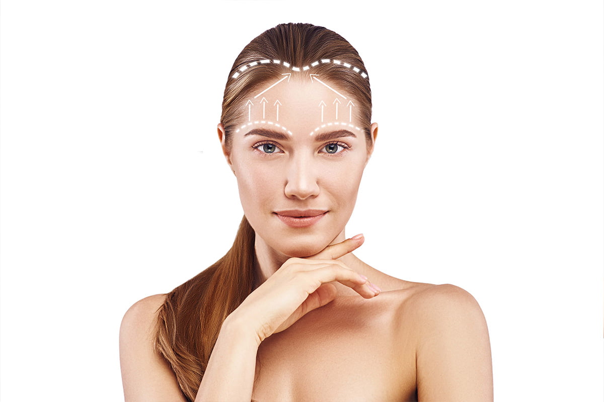 Forehead and Brow Lifting