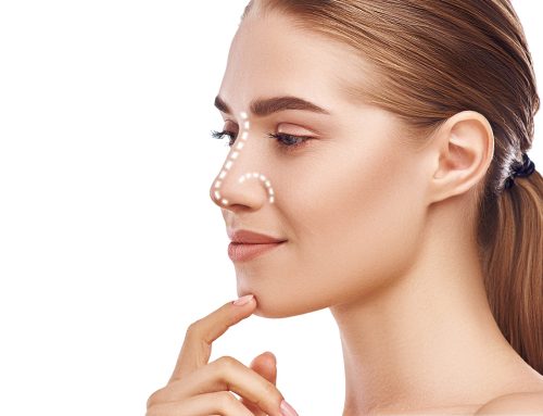 Rhinoplasty