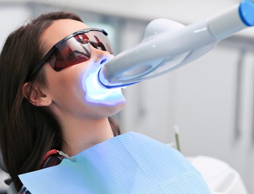 Teeth Whitening