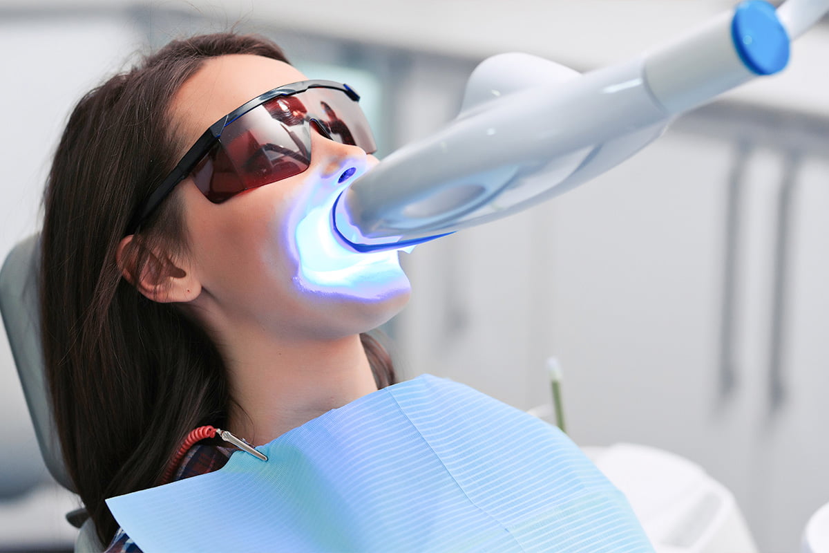 Teeth Whitening